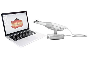 intraoral scanner